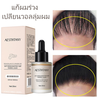 เซรั่มปลูกผม น้ำยาเร่งผมยาว เซรั่มขิง ปลูกผม 30ml น้ำยาปลูกผม เซรั่มปลูกผม ป้องกันผมร่วง บอกลางความบาง บำรุงผม ผมดกกำ