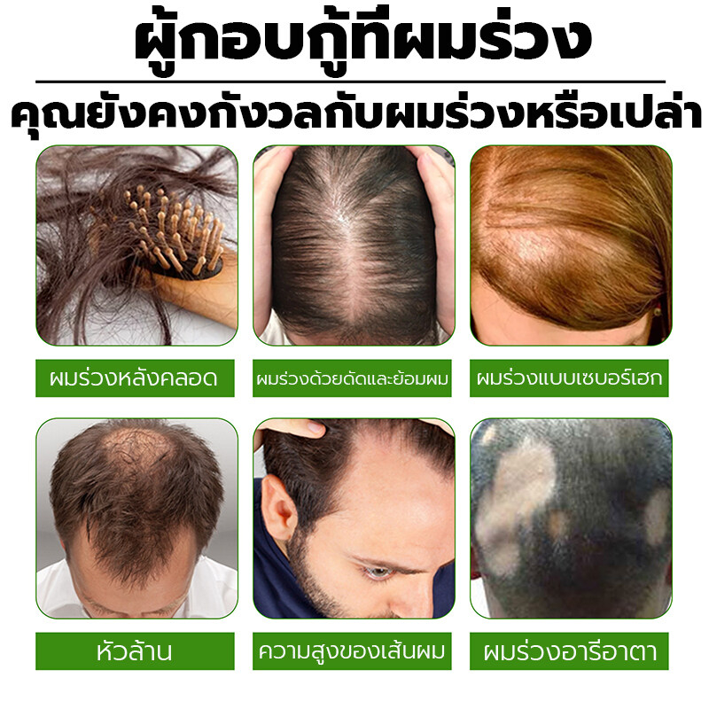 เซรั่มปลูกผม 120ml น้ำยาปลูกผมดก น้ำยาเร่งผมยาว ยาปลูกผมของแท้ น้ำยาปลูกผมผู้ชาย ป้องกันผมร่วง ทำให้รากผมแข็งแรงมากขึ้น - รูปที่ 4