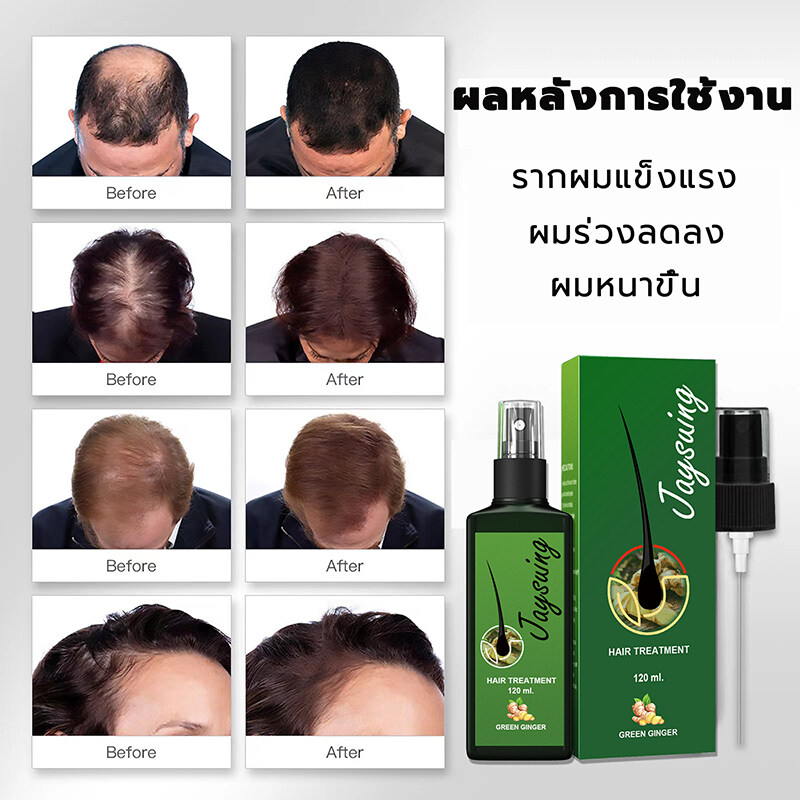 เซรั่มปลูกผม 120ml น้ำยาปลูกผมดก น้ำยาเร่งผมยาว ยาปลูกผมของแท้ น้ำยาปลูกผมผู้ชาย ป้องกันผมร่วง ทำให้รากผมแข็งแรงมากขึ้น - รูปที่ 5