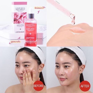 เซรั่ม กุหลาบ ของแท้ 100% ล็อตใหม่ 100mL MEDI PEEL Luxury Royal Rose Ampoule ผิวสวยกระจ่างใส กุหลาบ หมดอายุ 10/2025