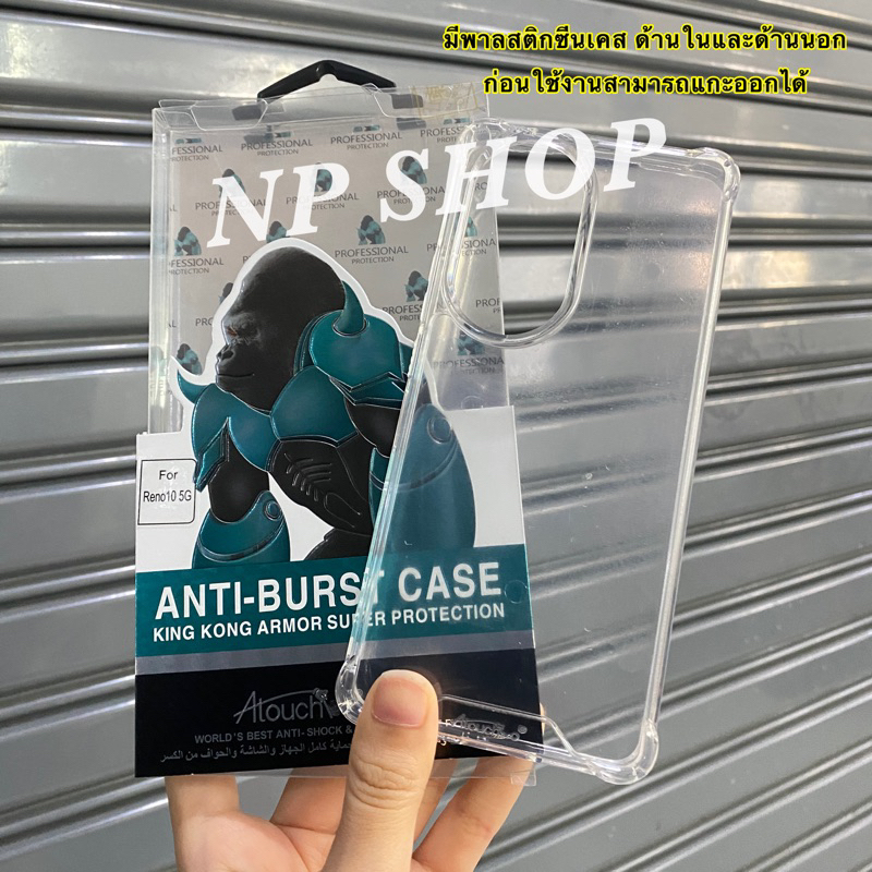 📮พร้อมส่ง เคสใสกันกระแทก คิงคอง สำหรับรุ่น OPPO Reno10/Reno10Pro/Reno10Pro Plus/Reno8T