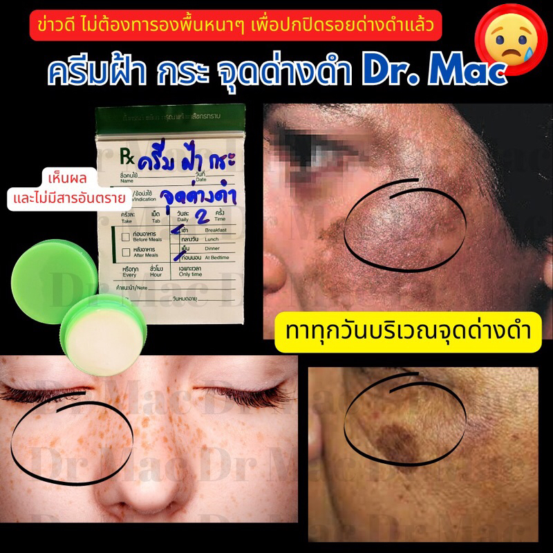 ครีมทาฝ้า กระ จุดด่างดำ Dr Mac เซรั่มฝ้ากระ เพื่อผิวหน้ากระจ่างใส ลดเลือน ฝ้า กระ จุดด่างดำ