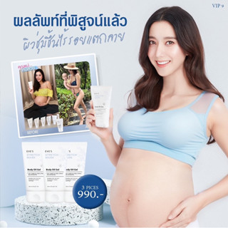 Eve’s เซ็ตออยเจล 3 หลอด ออยเนื้อเจลป้องกันการแตกลายโดยเฉพาะ คุณแม่ตั้งครรภ์ใช้ได้