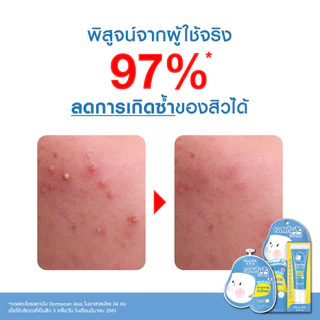 MizuMi Peptide Acne Gel (9g x 1 หลอด) เจลแต้มสิว สิวอักเสบ สิวไม่มีหัว แดงบวม ผิวเป็นสิว ผิวแพ้ง่าย