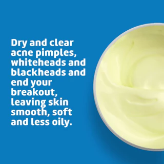De La Cruz, Acne Treatment Ointment with 10% Sulfur, Maximum Strength, 2.6 oz (73.7 g) ขี้ผึ้งรักษาสิว