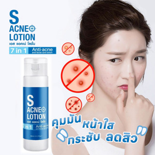 S ACNE LOTION เอส แอคเน่ โลชั่น คุมมัน หน้าใส กระชับ ลดสิว 60ml.