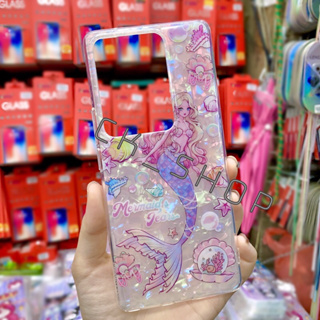 ‼️New‼️ เคสหินมุก ลายการ์ตูน Vivo Y22/Y22S/Y17/Y15/Y12/Y11 (📸ถ่ายจากสินค้าจริง)📮สินค้าพร้อมส่งในไทย💖