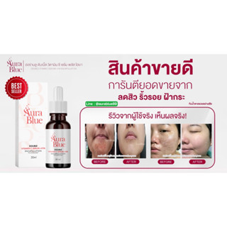 เซรั่มออร่าบลู Aura Blue เซรั่มต้นหอม​ ออร่าบลู​ ลด​สิว​ เซรั่มหน้าใส​ aurablue