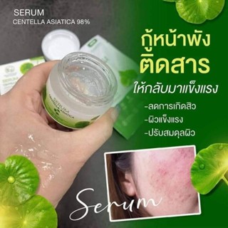 เซรั่มใบบัวบก 1กระปุก ลดสิว ผิวติดสาร กู