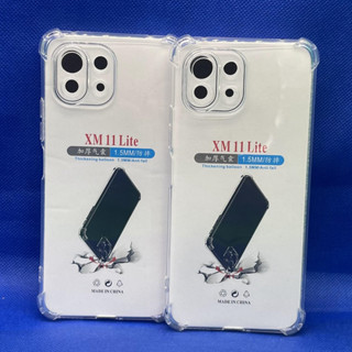 Case Xiaomi  MI11lite  หนา 1.5mm ตรงรุ่น แบบ TPU ใสเสริมขอบและมุมกันกระแทก ซิลิโคนนิ่ม ส่งไว จาก กทม