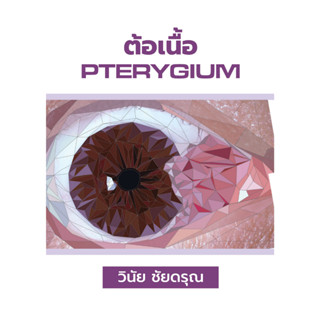 (ปกแข็ง) ต้อเนื้อ (PTERYGIUM) 9786165980524