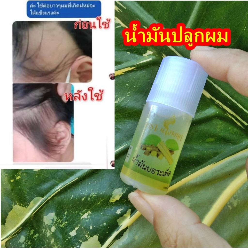 (พร้อมส่ง) น้ำมันบอระเพ็ด น้ำมันปลูกผมดกดำใน1เดือน น้ำมันปลูกผมนางพญา ราคา ถูกที่สุด ดีลบีเคเค แกลเลอรีภาพที่ 2