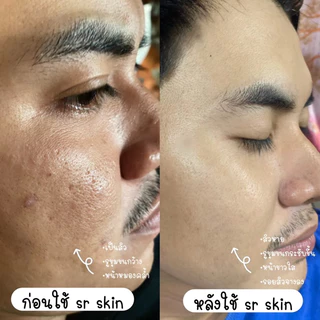 #พร้อมส่ง🍒 SR SKIN ครีมอาร์บูติน ของแท้💯(มีปลายทาง)