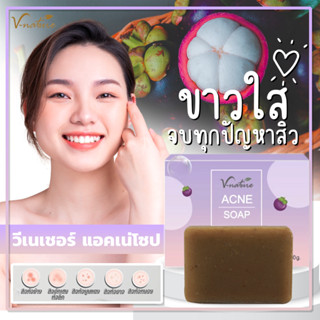 V-Nature Acne Soap สบู่สิว ลดสิว ฝ้า หน้าใส ลดสิวอุดตัน ลดหน้ามัน ลดสิวหน้าใส รอยสิวเดิมจางลง สบู่สิวหลัง สิวเสี้ยน