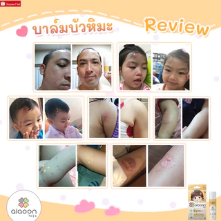 ไออุ่น บาล์มบัวหิมะออร์แกนิค 15 g.(aiaoon Organic Soothing Balm with Snow Lotus Extract)