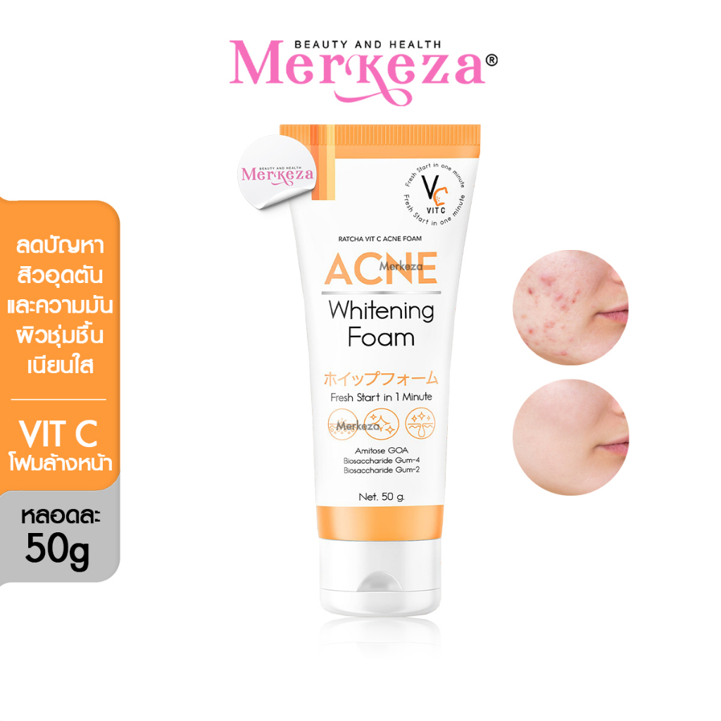 Ratcha Vit C Acne Foam รัชชา วิตซี แอคเน่ โฟมล้างหน้า สูตรเข้มข้น น้องฉัตร วิปโฟม ทำความสะอาด ผิวหน้