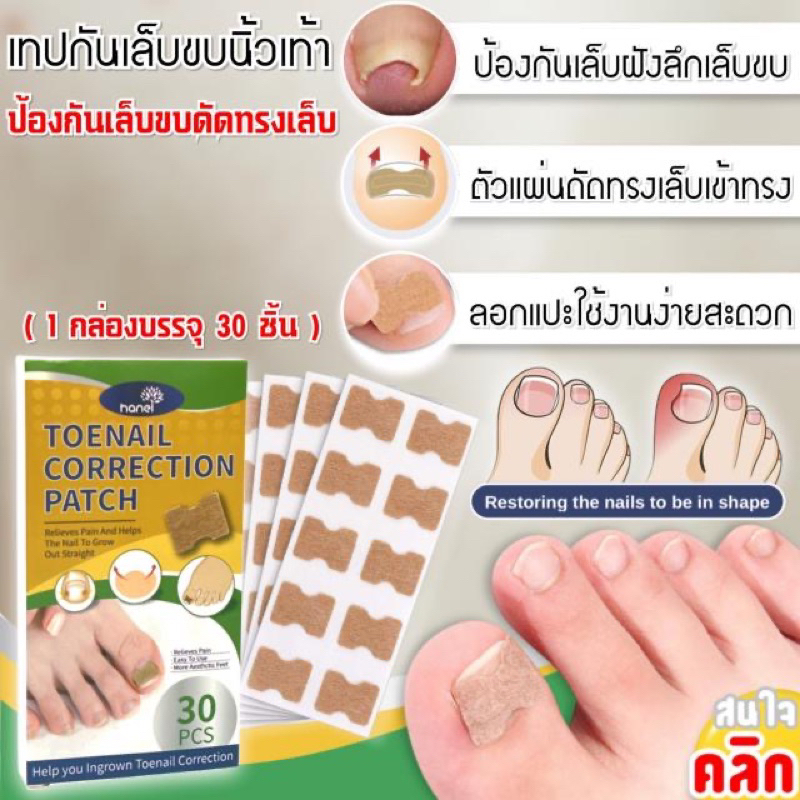 เทปแปะเล็บขบ แก้ปวดเล็บขบ ( 30 ชิ้น/กล่อง )