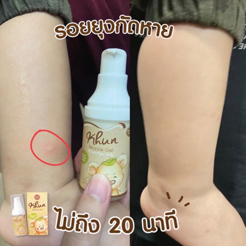 Khun สเปรย์กันยุง / เจลลดคัน ลดรอยดำ จากยุงมดแมลงกัด สำหรับเด็ก ตุ่มยุบภายใน20นาที ออแกนิค100% ใช้ได้ตั้งแต่แรกเกิด ราคา ถูกที่สุด ดีลบีเคเค แกลเลอรีภาพที่ 4