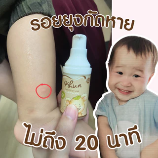 2ชิ้นถูกกว่า! KHUN คุนเจลทารอยยุงกัด ไม่ทิ้งรอยดำ สูตรออร์แกนิค อ่อนโยน สำหรับเด็ก 18ml. (2ชิ้น)