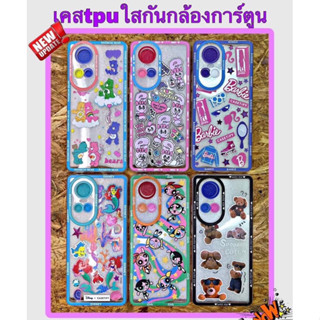 ‼️NEW‼️เคส TPUลายการ์ตูน OPPO A58(4G) 🚛ตรงรุ่น 📸เคสTPUใสกันกล้องการ์ตูน Oil 🚛 สินค้าพร้อมส่งจากไทย🇹🇭