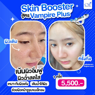 [E-Voucher] Skin Booster สูตร Vampire Plus by Charmer Clinic