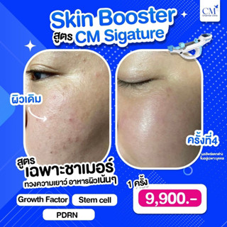 [E-Voucher] Skin Booster สูตร CM Sigature by Charmer Clinic