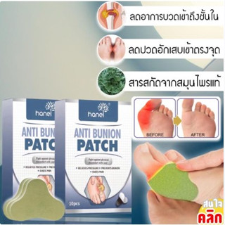 Hanel Anti bunion patch แผ่นแปะเท้าสมุนไพรลดปวดบวม