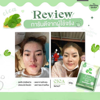 ☘️☘️สบู่ใบบัวบก ออแกนิคCica(50 กรัม) ช่วยลดสิว กระชับรูขุมขน ลดการระคายเคือง และจุดด่างดำให้จางลด