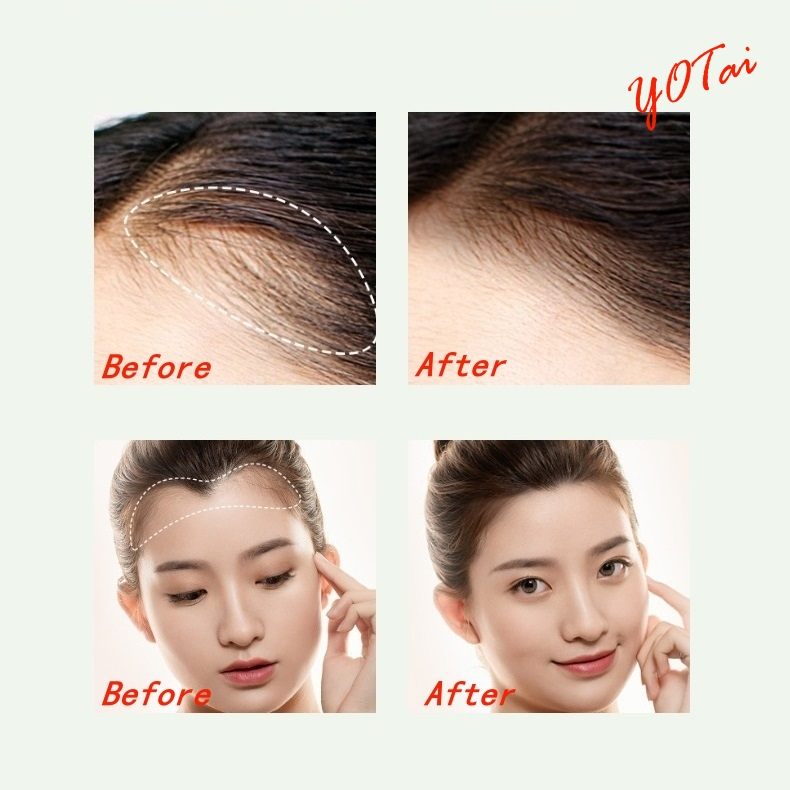 YOTAI แป้งเงาผม กันน้ํา ติดทนนาน ผงแฮร์ไลน์ แป้งฝุ่นปิดหัวเถิก หัวเหม่ง หัวล้าน ปิดผมหงอก ตกแต่งไรผมให้ดูหนาขึ้น - รูปที่ 4