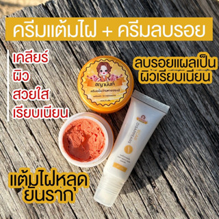 [ของแท้] ครีมไฝ+ลบรอย ชญานันท์ ขี้แมลงวัน ติ่งเนื้อ หูด ตาปลา แก้ปัญหา กระ สิวหิน หูด จี้ไฝ แต้มไฝ