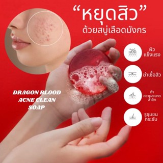 สบู่ล้างหน้าลดสิว ควบคุมความมัน สบู่เลือดมังกร