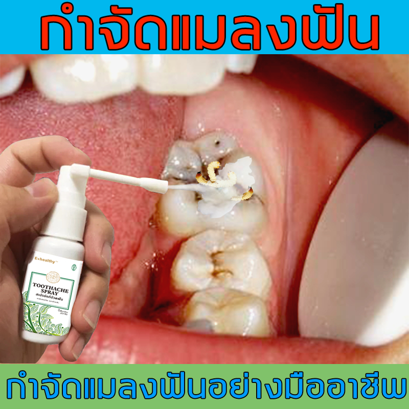 YIMIWEILAI แก้ปวดฟัน เหงือกอักเสบ ใช้หมดก็เห็นผล ช่วยลดอาการเจ็บฟันได้เป็นอย่างดี สเปรย์พ่นคอ ปวดฟัน สเปรย์แก้ปวดฟัน