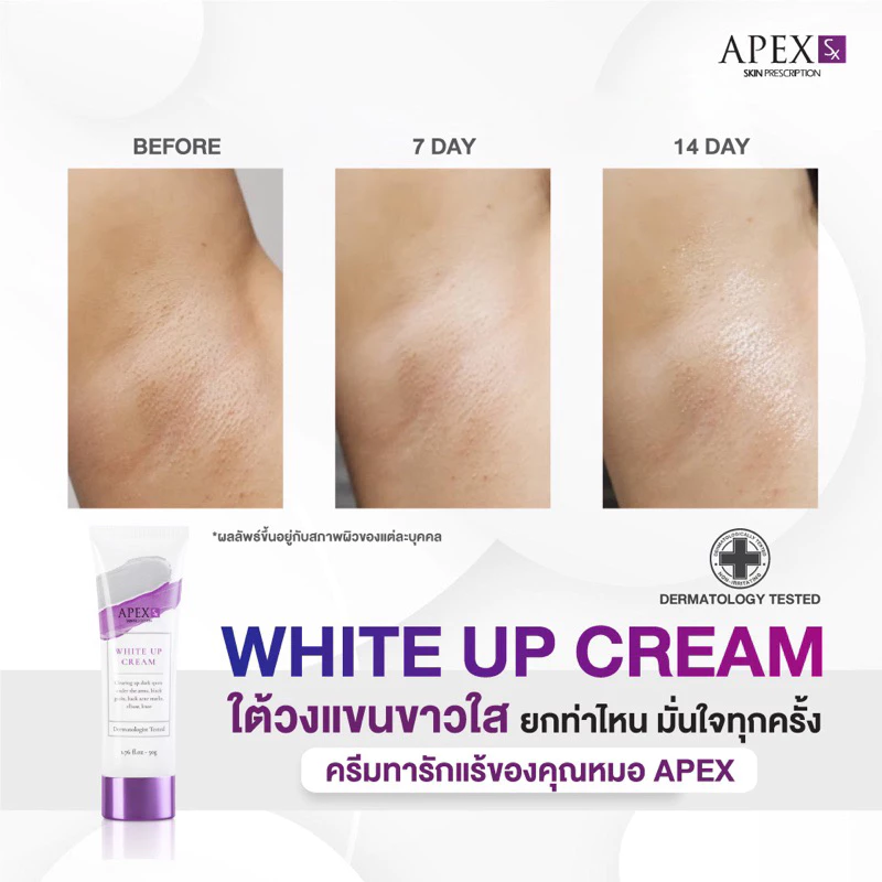 APEX-SX WHITE UP CREAM ครีมทารักแร้ขาว โดยแพทย์ผิวหนังเอเพ็กซ์ ทาขาหนีบดำ แก้มก้นดำ 50 ml. thumbnail 5