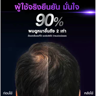 CLEAR MEN เคลียร์ เมน แชมพู ลดผมร่วง ลดผมบาง เพิ่มวอลลุ่ม ยาสระผม ผู้ชาย (สูตรลดผมขาดหลุดร่วง ผมบาง ผมหนาขึ้น)
