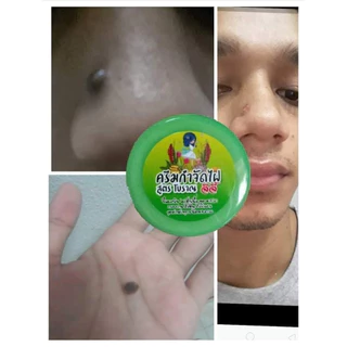 ครีมไฝ จีจี้ แต้มไฝ 🚚 พร้อมส่ง ✅ ขี้แมลงวัน หูด ตาปลา ติ่งเนื้อ ⏩ของแท้⏪ หลุดจริง‼️ กำจัด ไฝ ครีมแต้มไฝ 012