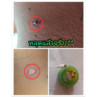 ครีมไฝ จีจี้ แต้มไฝ 🚚 พร้อมส่ง ✅ ขี้แมลงวัน หูด ตาปลา ติ่งเนื้อ ของแท้ หลุดจริง‼️ กำจัด ไฝ ครีมแต้มไฝ 1218