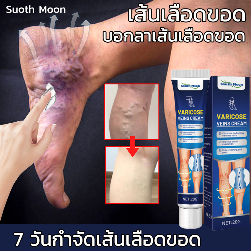 แท้100% ครีม ทา เส้นเลือดขอด ของแทั เส้นเลือดฝอยแตก ครีมทาเส้นเลือดขอด เส้นเลือดขอด ส่งเสริมการไหลเวียนโลหิต
