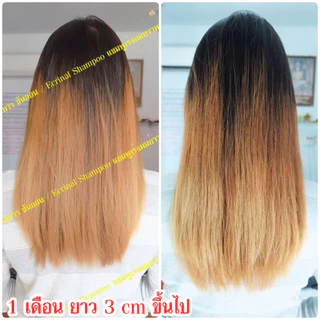 !!ส่งไว!! แชมพูเร่งผมยาวพลังม้า เฟอรินอล (Ferinal) แชมพูเร่งผมยาว เห็นผลทันที!! เพียงแค่ขวดแรกที่ใช้