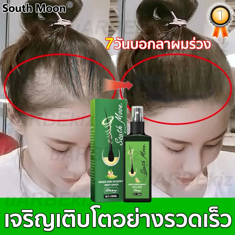 【บอกลาหัวล้าน ปลูกผมหนา ช่วยลดผมร่วง 】สเปรย์ปลูกผม ยาปลูกผม ป้องกันผมร่วงน้ำยาเร่งผมยาว น้ำยาปลูกผม เร่งผมยาวไว แก้ปัญหา
