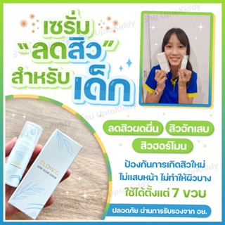 [🔥ล็อตใหม่ ส่งไว🔥] เซรั่มสิวเด็ก เซรั่มลดสิวสำหรับเด็ก สูตรอ…