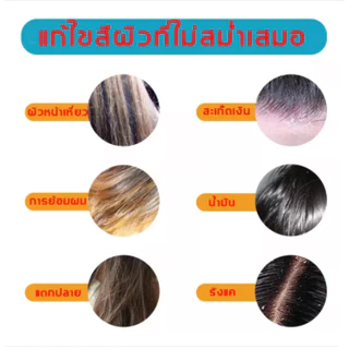แชมพู zudaifu ของแท้100% แชมพูขจัดรังแค ยาสระผมลดผมร่วง คันหัว ช่วยบำรุงเส้นผมและหนังศรีษะ ขนาด120ml
