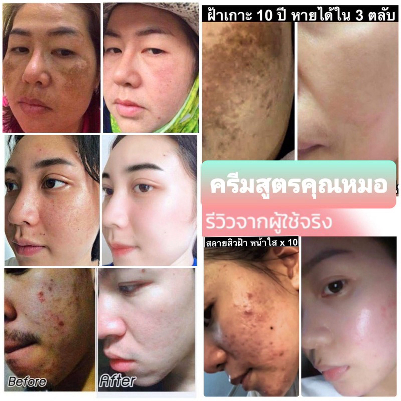 ⚡ของแท้💯 พร้อมส่ง⚡ CK ครีมแตงกวา ครีมฝ้า ครีมหน้าเงา ครีมฝ้า ครีมสิว ครีมหน้าเด้ง - รูปที่ 4