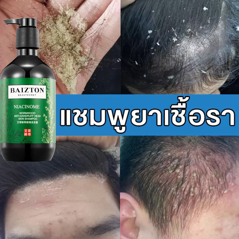แชมพูขจัดรังแค ไม้วอร์มวูดแชมพู500ml แชมพูรักษารังแค ควบคุมความมันและกำจัดรังแค แก้ปัญหาตั้งแต่ต้นตอของหนังศีรษะ
