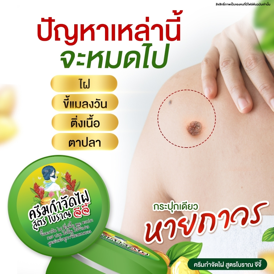 ครีมไฝจีจี้ ขี้แมลงวัน ไฝ ติ่งเนื้อ หูด ตาปลา แก้ปัญหา กระ สิวหิน ไฝ หูด จี้หูด แต้มไฝ