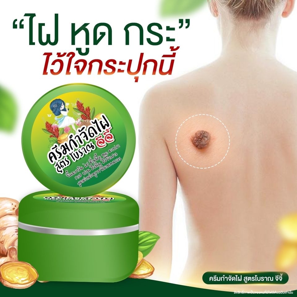 ครีมไฝจีจี้ ขี้แมลงวัน ติ่งเนื้อ หูด ไฝ ตาปลา แก้ปัญหา กระ สิวหิน ไฝ หูด จี้หูด แต้มไฝ