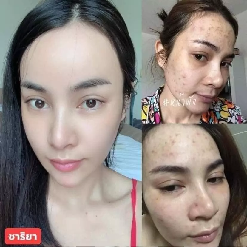 Chariya เซทหน้าสวยมินิ เดย์ครีม ไนท์ครีม 5g แถมเซรั่มแพลงตอน 10g thumbnail 10