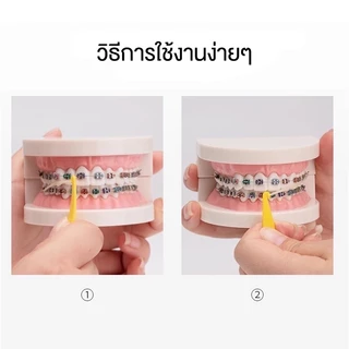 (ส่งจากไทย) ที่เกี่ยวยางดึงฟัน ยางคล้องฟัน ที่ถอดรี อุปรณ์สำหรับคนจัดฟัน ที่เกี่ยวฟัน