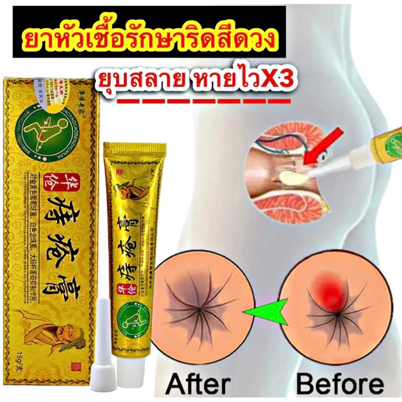 พร้อมส่งด่วน สูตรใหม่สลายไวไม่ต้องผ่า