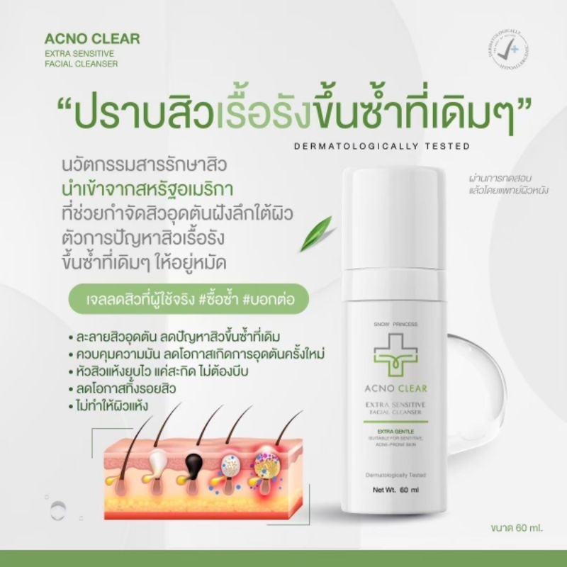 ส่งฟรี ของแท้ เจลล้างหน้าแอคโนเคลียร์ 60ml Acnoclear สูตรผิวแพ้ง่าย อ่อนโยน ลดปัญหาสิว ผิวมัน ได้ตรงจุด สูตรอ่อนโยน