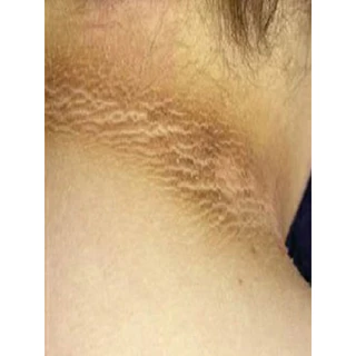 สบู่ทิพย์สุฟอกผิวกายขจัดคราบครีม&ขี้ไคลTHIPS SKINCLEANSING SOAP